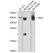 Western blot analysis of extracts of various cell lines using ARG2 Antibody (1/1000 dilution).