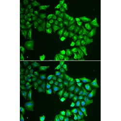 Argininosuccinate Lyase (ASL) Antibody