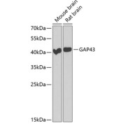 Western blot analysis of extracts of various cell lines using GAP43 Antibody (1/1000 dilution).