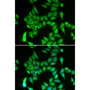 Immunofluorescence analysis of A549 cells using IREB2 Antibody