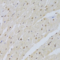 U1 Small Nuclear Ribonucleoprotein A (SNRPA) Antibody