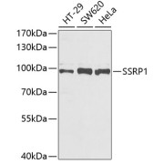 Western blot analysis of extracts of various cell lines using SSRP1 Antibody (1/1000 dilution).