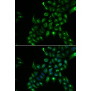 abx004911