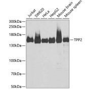 Western blot analysis of extracts of various cell lines using TPP2 Antibody (1/1000 dilution).