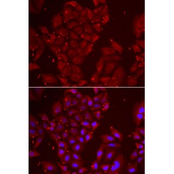 Tripeptidyl-Peptidase 2 (TPP2) Antibody
