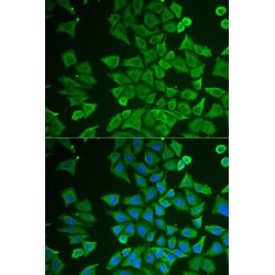 Dimethylarginine Dimethylaminohydrolase 2 (DDAH2) Antibody