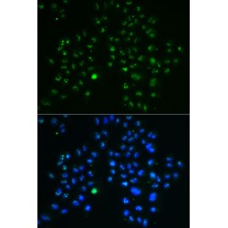 Guanine Nucleotide Binding Protein Like 3 (Nucleolar) (GNL3) Antibody