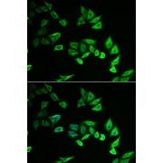 Immunofluorescence analysis of U2OS cells using MYOZ2 Antibody