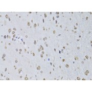 Immunohistochemistry of paraffin-embedded Rat brain using LMNB2 Antibody (1/100 dilution, 40x lens).