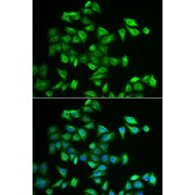 Immunofluorescence analysis of A549 cells using POMGNT2 Antibody