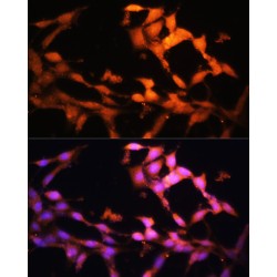 Folliculin (FLCN) Antibody