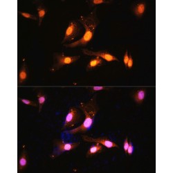 Folliculin (FLCN) Antibody