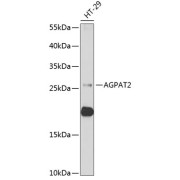abx004998