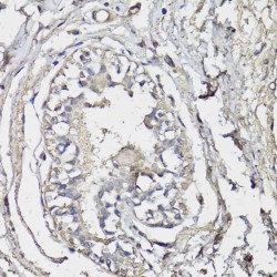 Ubiquitin Carboxyl-Terminal Hydrolase BAP1 (BAP1) Antibody