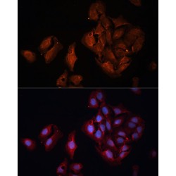 Ubiquitin Carboxyl-Terminal Hydrolase BAP1 (BAP1) Antibody