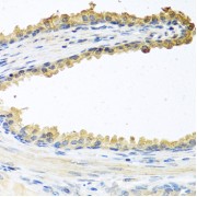 Immunohistochemistry of paraffin-embedded Human prostate using COCH Antibody (1/100 dilution, 40x lens).