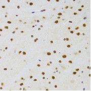Immunohistochemistry of paraffin-embedded Rat brain using CSRP3 Antibody (1/100 dilution, 40x lens).