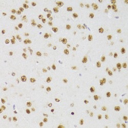 Cysteine And Glycine Rich Protein 3 (CSRP3) Antibody