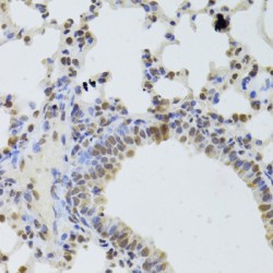 ATP-Dependent RNA Helicase DDX1 (DDX1) Antibody