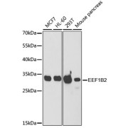 Western blot analysis of extracts of various cell lines using EEF1B2 Antibody (1/1000 dilution).
