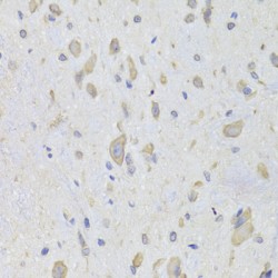 Elongation Factor 1-Beta (EEF1B2) Antibody