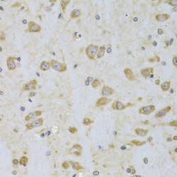 Elongation Factor 1-Beta (EEF1B2) Antibody