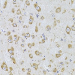 Elongation Factor 1-Beta (EEF1B2) Antibody