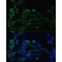 Elongation Factor 1-Beta (EEF1B2) Antibody