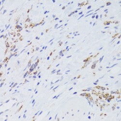 Glycine Amidinotransferase, Mitochondrial (GATM) Antibody