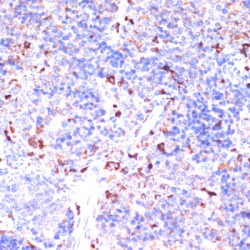 Glycine Amidinotransferase, Mitochondrial (GATM) Antibody