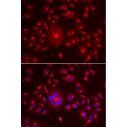 Golgi Reassembly-Stacking Protein of 65 kDa (GRASP65) Antibody