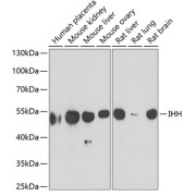Western blot analysis of extracts of various cell lines using IHH Antibody (1/1000 dilution).