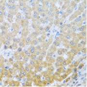 Immunohistochemistry of paraffin-embedded Human liver using IL20 Antibody (1/100 dilution, 40x lens).