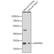Western blot analysis of extracts of various cell lines using MAPRE2 Antibody (1/1000 dilution).