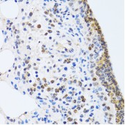 Immunohistochemistry of paraffin-embedded Rat lung using MTA3 Antibody (1/100 dilution, 40x lens).