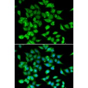 Immunofluorescence analysis of HeLa cells using NFATC3 Antibody