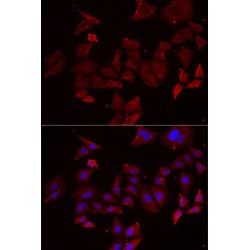 Nephrocystin 1 (NPHP1) Antibody