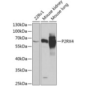 Western blot analysis of extracts of various cell lines using P2RX4 Antibody (1/1000 dilution).