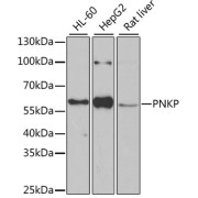 Western blot analysis of extracts of various cell lines using PNKP Antibody (1/1000 dilution).