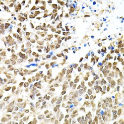 Bifunctional Polynucleotide Phosphatase/kinase (PNKP) Antibody