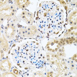 Bifunctional Polynucleotide Phosphatase/kinase (PNKP) Antibody