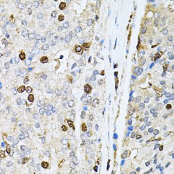 Bifunctional Polynucleotide Phosphatase/kinase (PNKP) Antibody