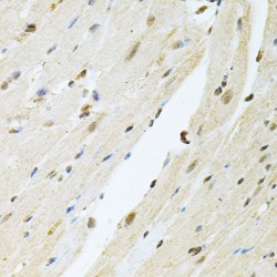 Bifunctional Polynucleotide Phosphatase/kinase (PNKP) Antibody