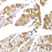 Immunohistochemistry of paraffin-embedded Mouse heart using PPP1R12A Antibody (1/100 dilution, 40x lens).