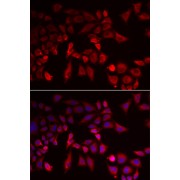 Immunofluorescence analysis of MCF-7 cells using PYGL Antibody