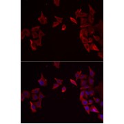 abx005152