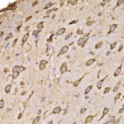 Ribosomal Protein S14 (RPS14) Antibody