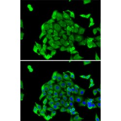 Ribosomal Protein S14 (RPS14) Antibody