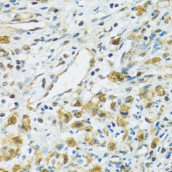 Ribosomal Protein S7 (RPS7) Antibody