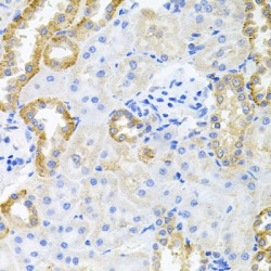 Striatin-3 (STRN3) Antibody